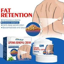 50G Lipoma Removal Cream Herbal Treatment For Safe And Effective Lipoma Reduction
